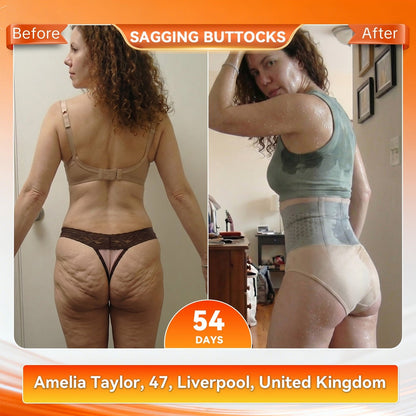 💦🍔GFOUK®☀️𝐌𝐨𝐫𝐢𝐧𝐠𝐚 & 𝐁𝐞𝐫𝐛𝐞𝐫𝐢𝐧𝐞 4‑In‑1 Micro‑Particle Sculpting & Fat‑Burn Shorts