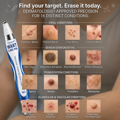 💧👨‍⚕️ Toclvo® Fast-Acting Wart Remover Care Pen | Targets Warts, Skin Tags & Rough Bumps