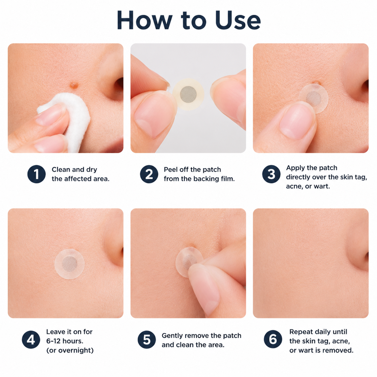 ✅🇦🇺Trilumia®2-in-1 Microneedle & Hydrocolloid Patch💫| Removes Raised Moles, Acne, Flat Warts & Skin Tags | Helps Improve Wrinkles, Scars & Blemishes | Invisible Patches for Face & Body
